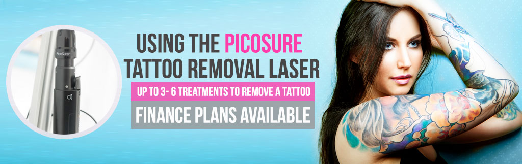 Best Laser Tattoo Removal Clinics In London
